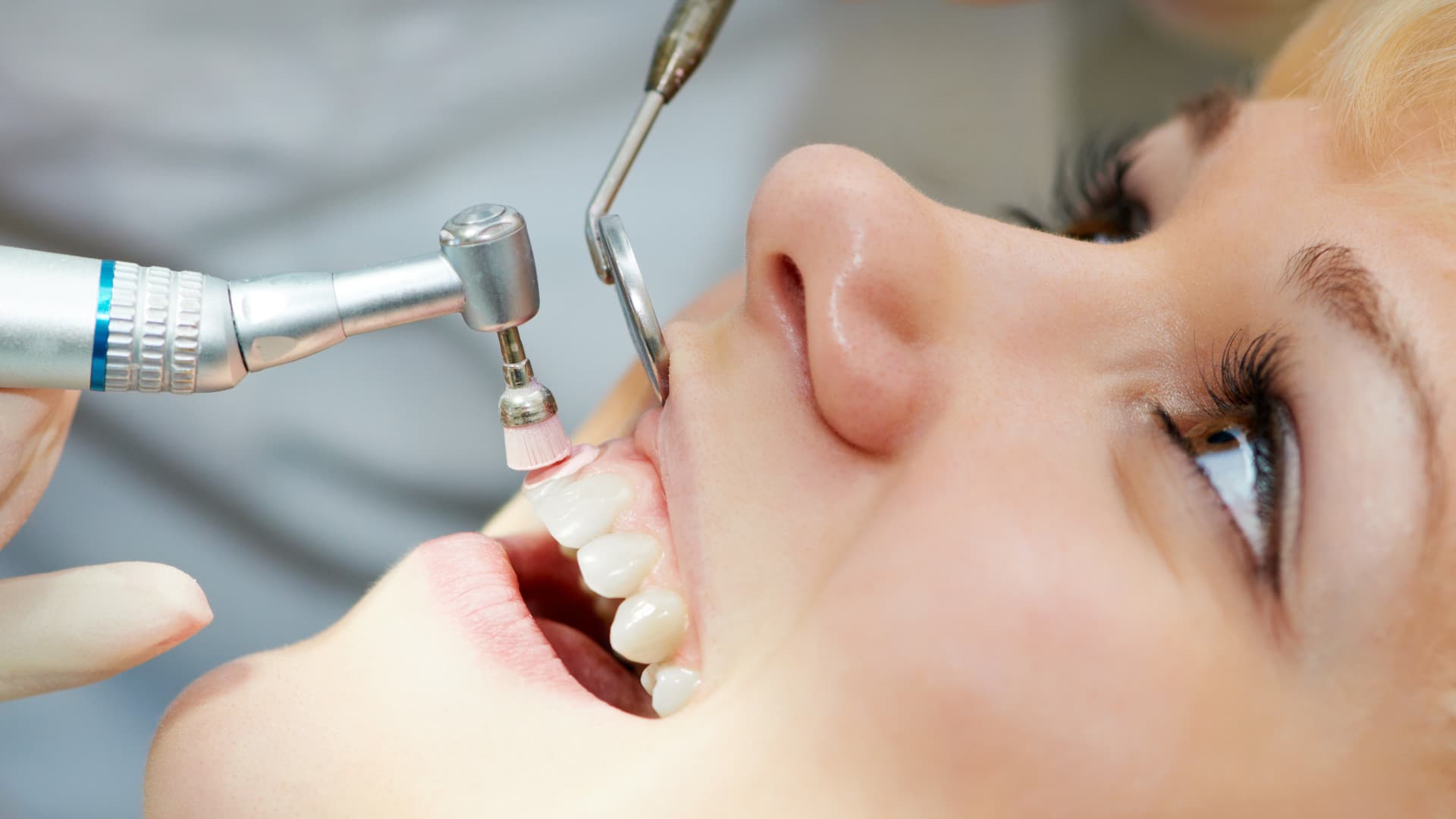 Diş Taşı Nedir? Diş Taşı Temizliği Nasıl Yapılır?